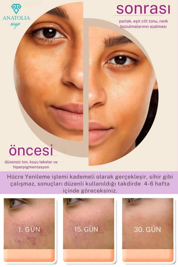 Retinage Kırışıklık Karşıtı, Onarıcı Ceramide A Vitamini Yaşlanma Karşıtı Üzüm Retinol Sabunu  - 2